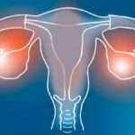 The Benefits of GyneCube: A Comprehensive Guide for Women